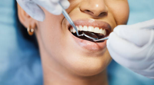 Best Same-Day Emergency Dental Services in Scottville, MI